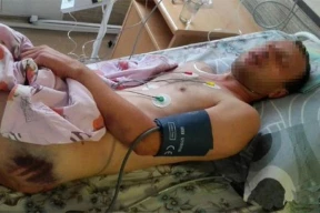 Цифра дня. Правозащитники собрали показания 450 избитых человек. А сколько возбуждено дел?